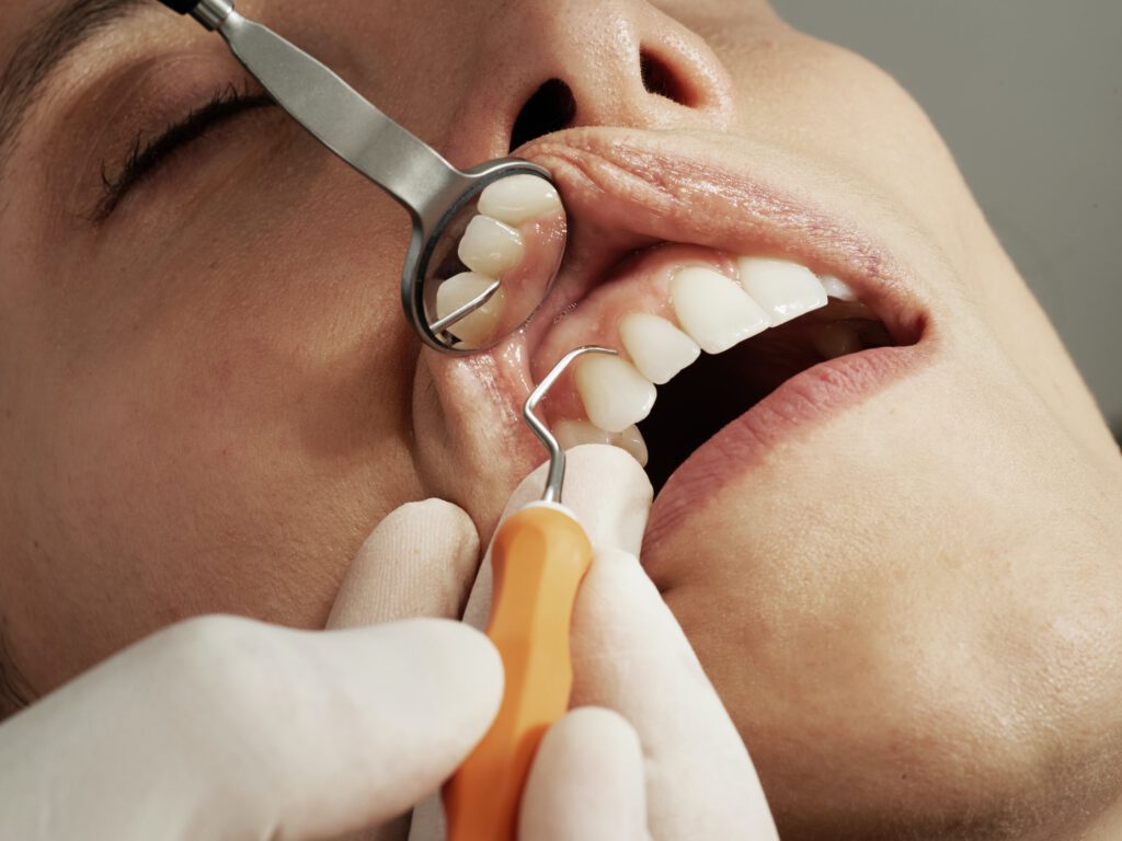tandarts zoetermeer